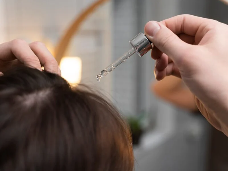 Essential Oil for Scalp Health